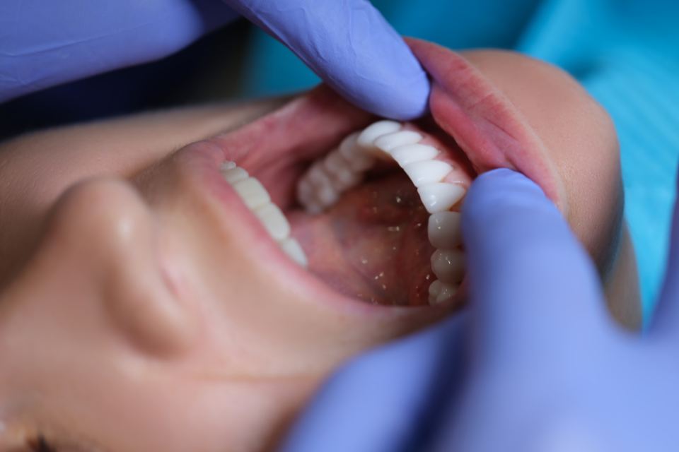 Gum and Tongue Inspecting for bacteria and disease - latest oral and dental health news